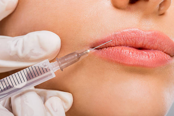 dermal fillers treatment